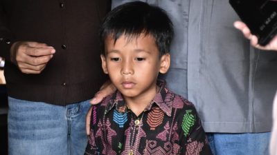 Kisah Alif Hidup Tanpa Anus, Biaya Operasional Selama Pengobatan Ditanggung Pemkab Sumedang